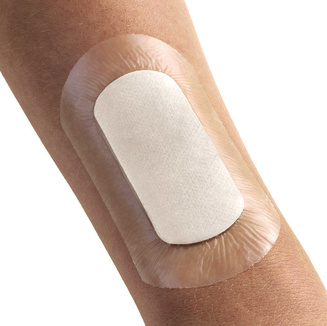 Example of the use of Cutiflex med waterproof plasters on the arm