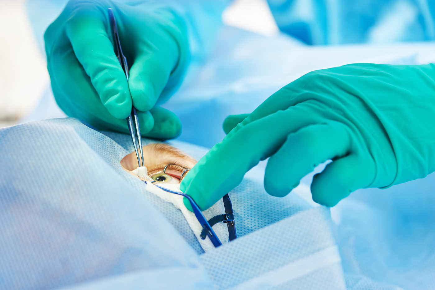 Patient having eye surgery, lid retractor spreading eye