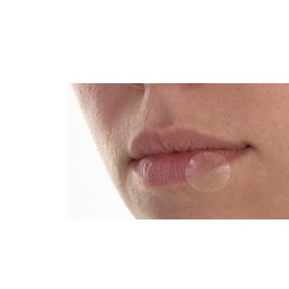 Aplicación del parche para herpes en el labio inferior