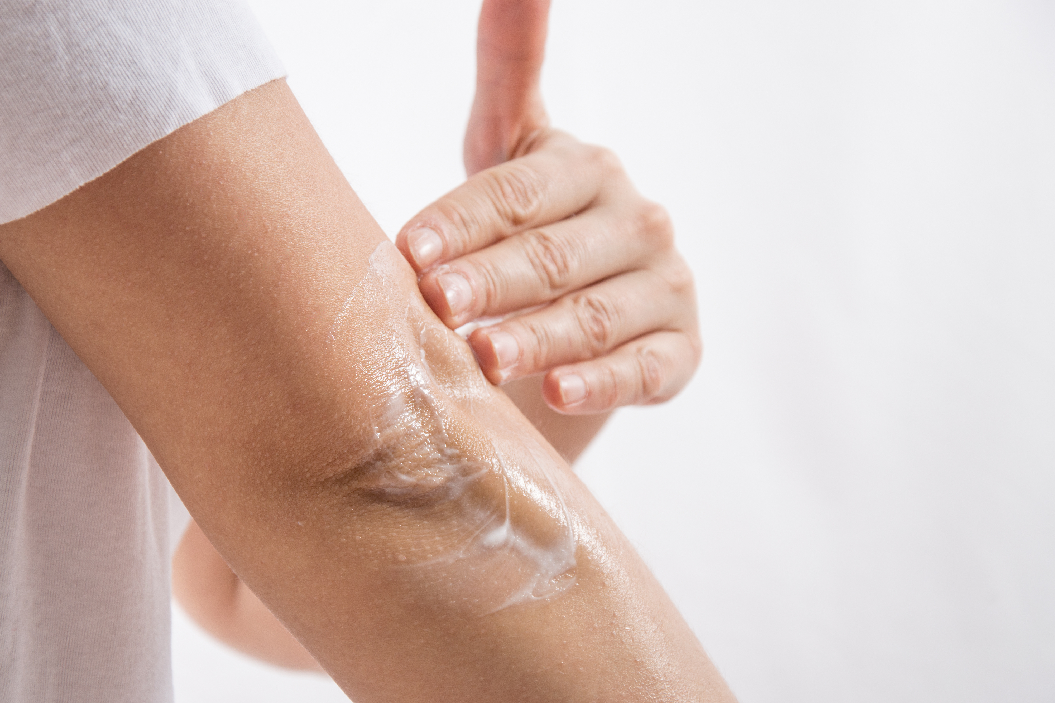 Hydrogel wird am sehr trockenen Unterarm aufgetragen